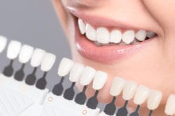 Professional Teeth Whitening Treatments